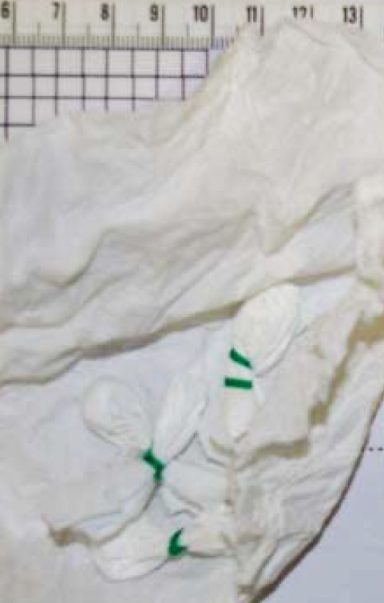 Clorhidrato de cocaína