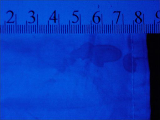 Localización de restos seminales Localización de restos seminales